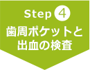 Step4 歯周ポケットと出血の検査