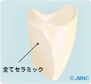 オールセラミッククラウン